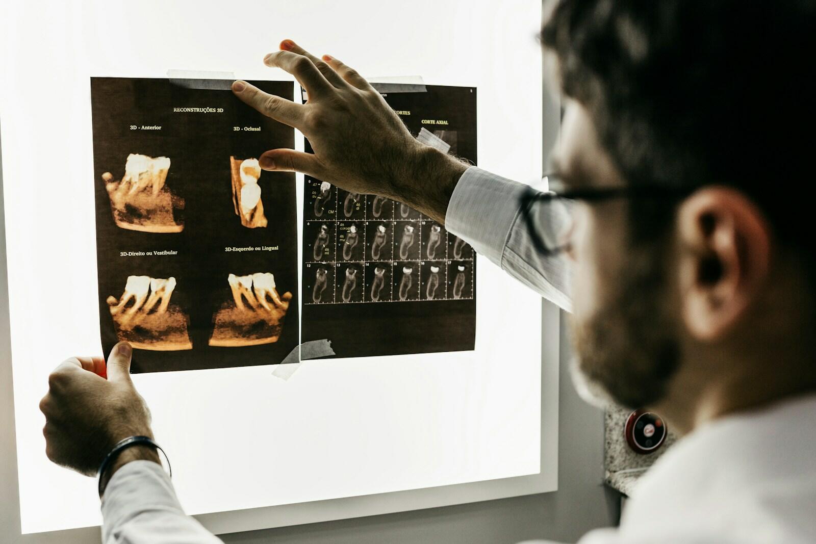 Endodoncia