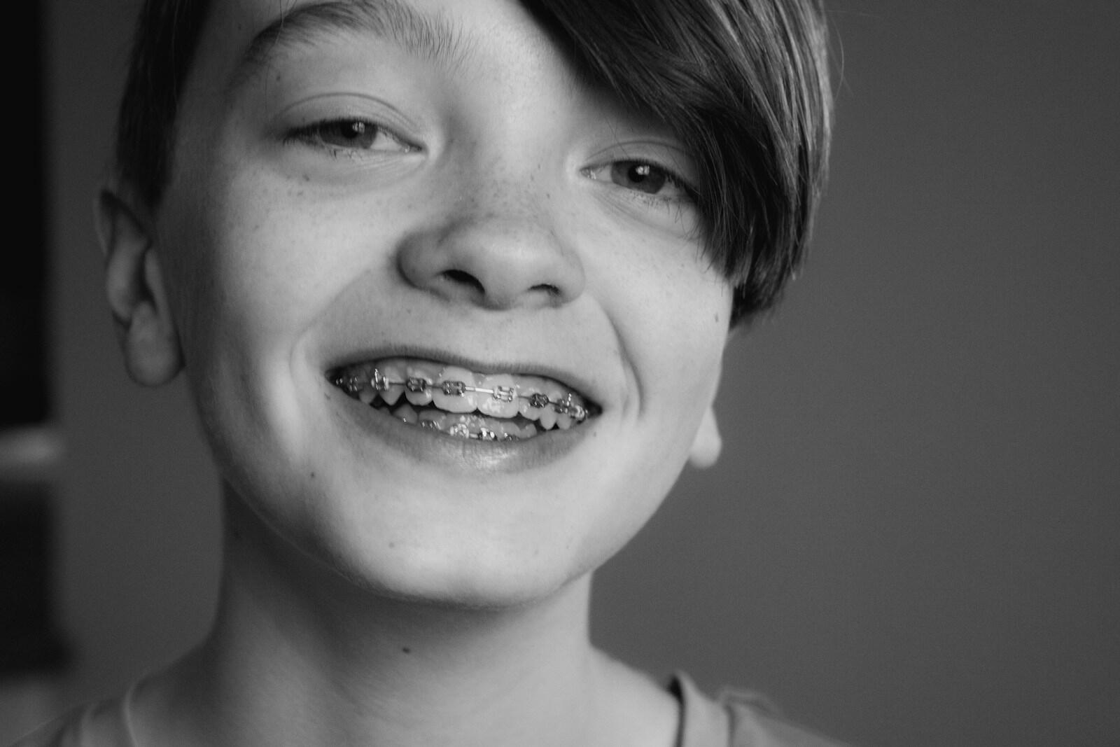 Brackets